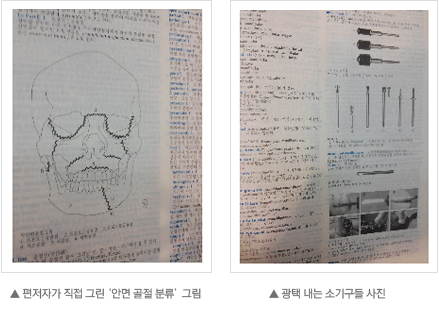 편저자가 직접 그린 ‘안면 골절 분류’ 그림  ▲ 광택 내는 소기구들 사진